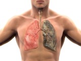 A Healthy Lung and a Nicotine Damaged Lung