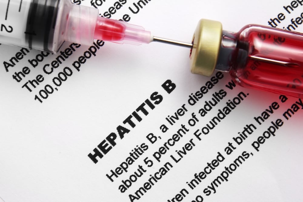 jaundice hepatitis b